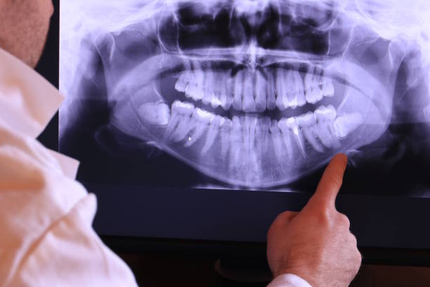 Best Broken or Chipped Tooth Repair in Barnesville, OH