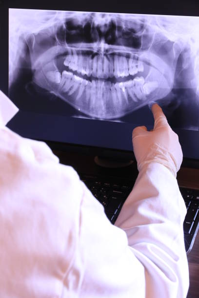 Best Emergency Treatment for Oral Infections in Barnesville, OH