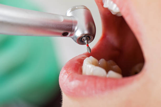 Best Emergency Dental Care for Sports Injuries in Barnesville, OH